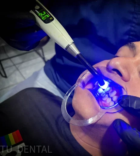 Dentista colocando brackets a un paciente como parte de tratamientos de ortodoncia en Tehuantepec.